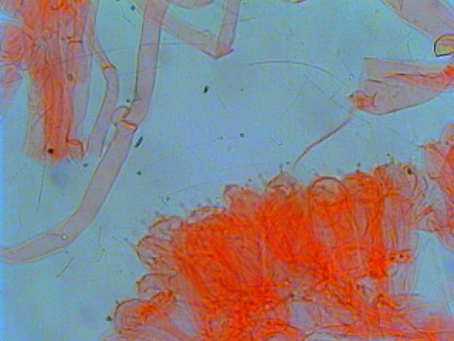 ancora Lepiota (cfr. Lepiota subincarnata)